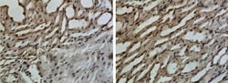 IL-10R alpha Antibody (RM0101-9E12) - Azide and BSA Free, Novus Biologicals:Antibodies:Primary